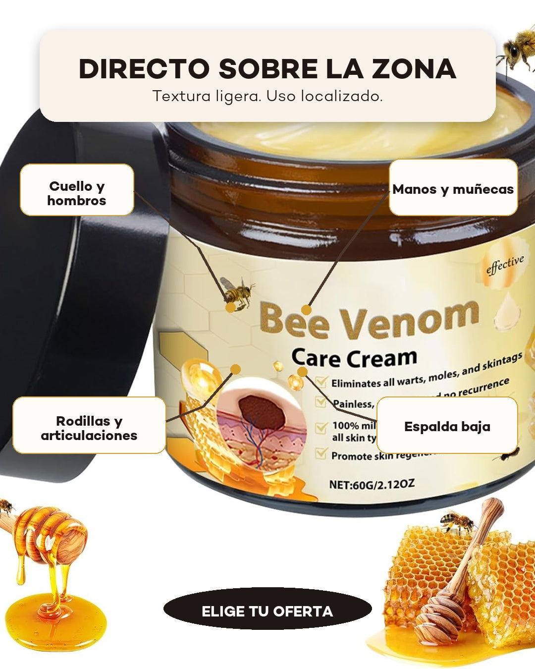 Explicación visual de zonas